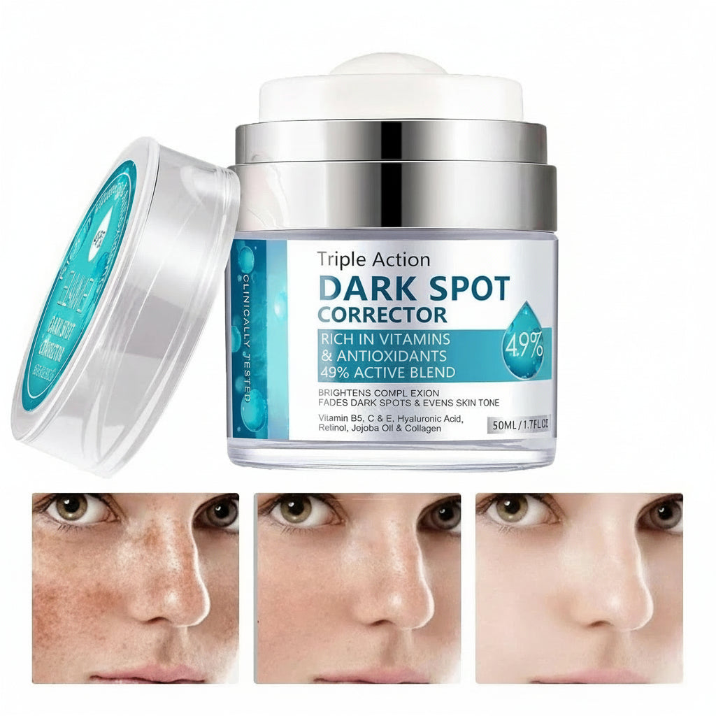 Crema Para Manchas Oscuras En La Cara, Cremas Quitar De La...